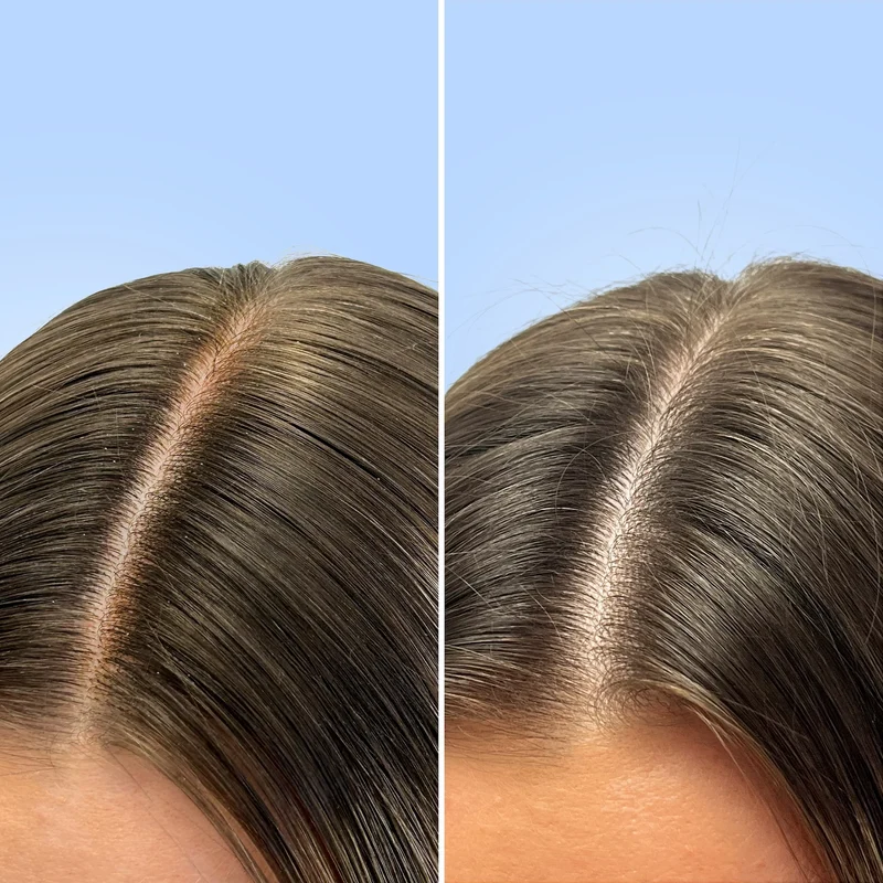 Shampoing purifiant