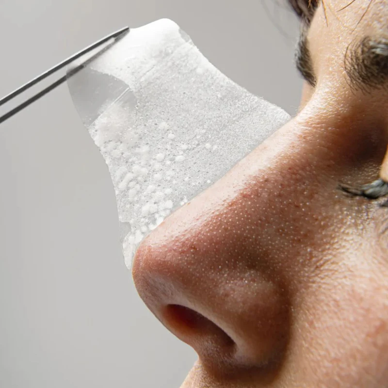 Patchs nez purifiants - Peel out