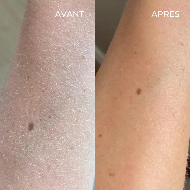 Crème corps onctueuse relipidante Body-Boost